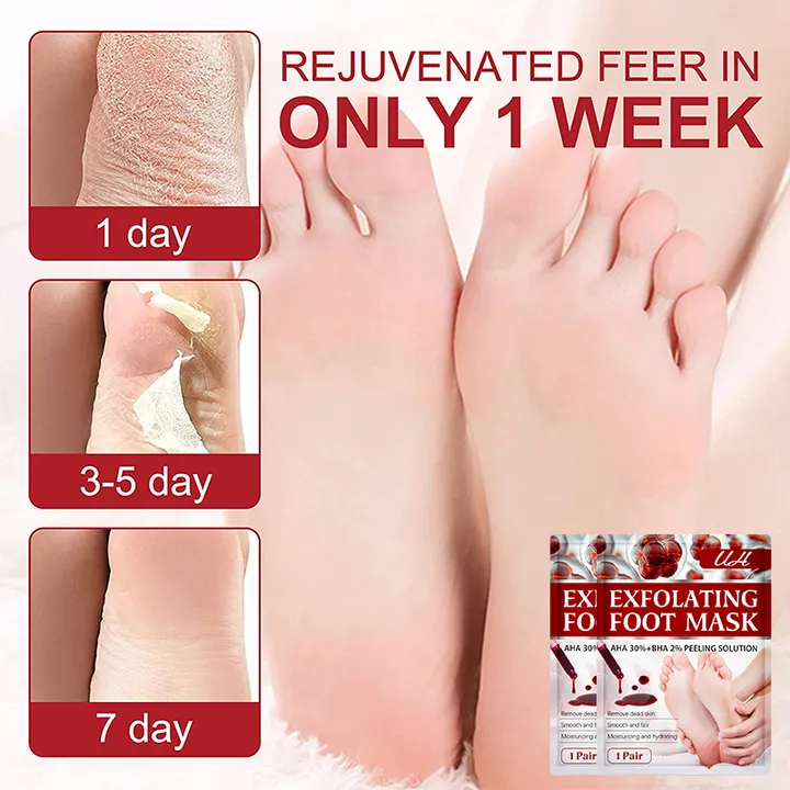 قناع تقشير القدمين لإزالة الجلد الميت والمسامير - Remove Dead Skin and Calluses Exfoliating Peeling Foot