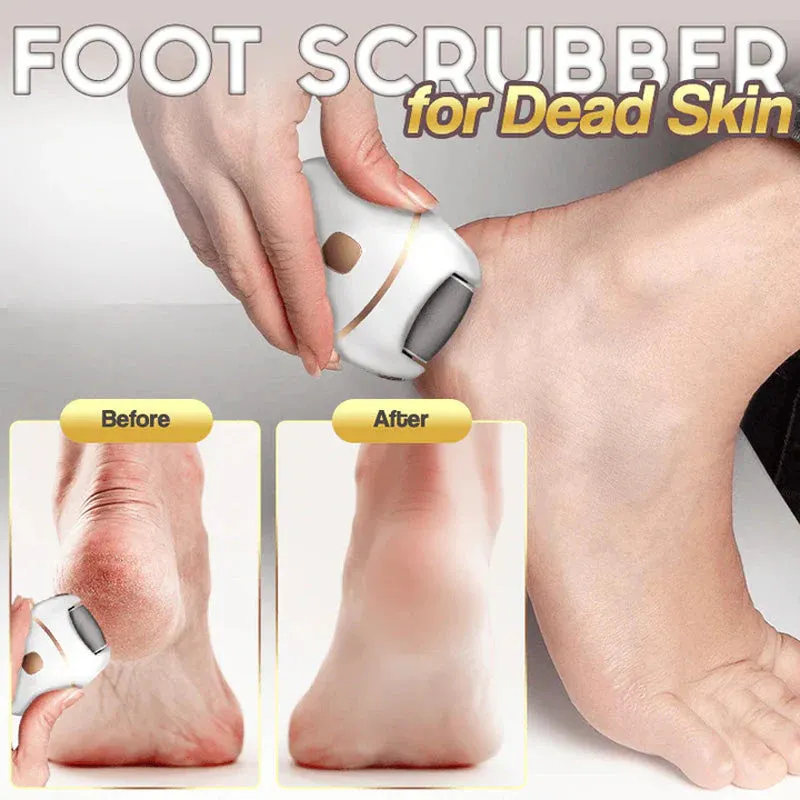 HOT SALE 49% OFFRechargeable Electric Foot Exfoliating Scrubber