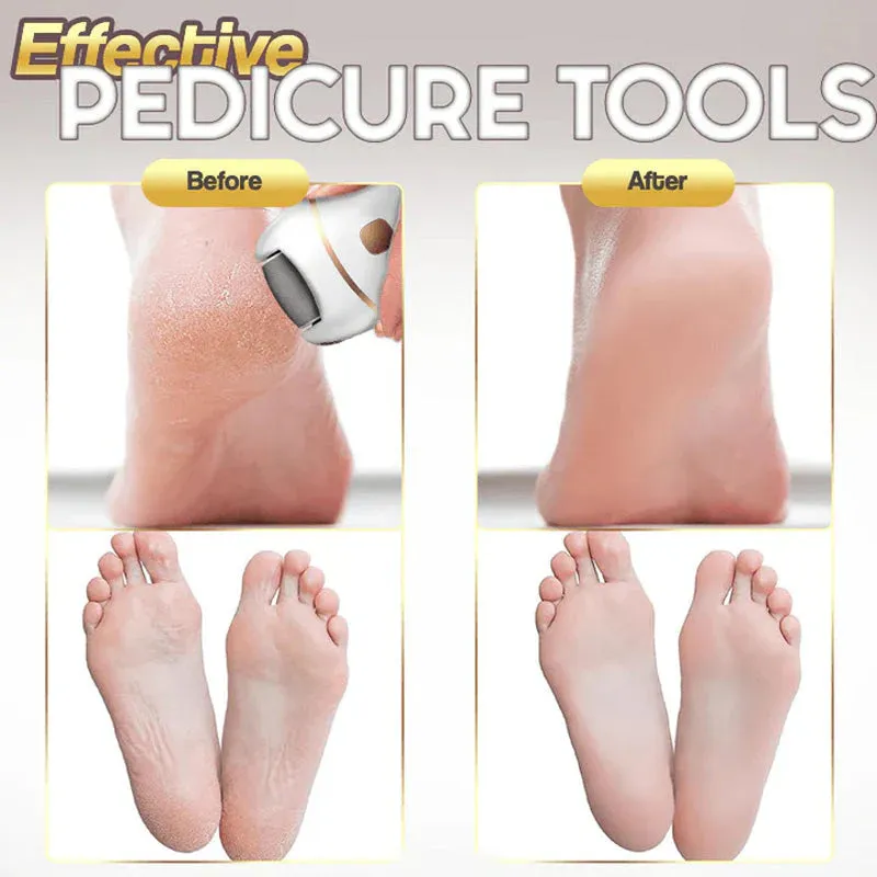 HOT SALE 49% OFFRechargeable Electric Foot Exfoliating Scrubber