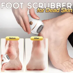 HOT SALE 49% OFFRechargeable Electric Foot Exfoliating Scrubber