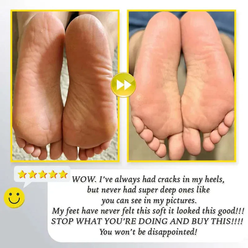 HOT SALE 49% OFFRechargeable Electric Foot Exfoliating Scrubber