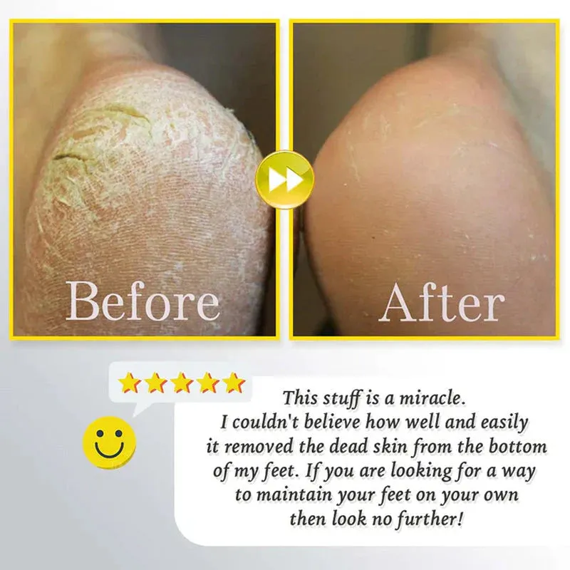HOT SALE 49% OFFRechargeable Electric Foot Exfoliating Scrubber